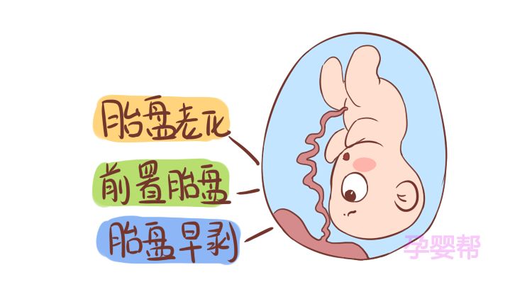 避免剥胎盘,避免前置胎盘的方法