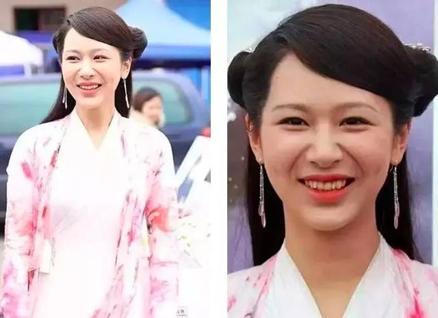 杨紫法令纹做了什么医美,杨紫笑起来法令纹特别深