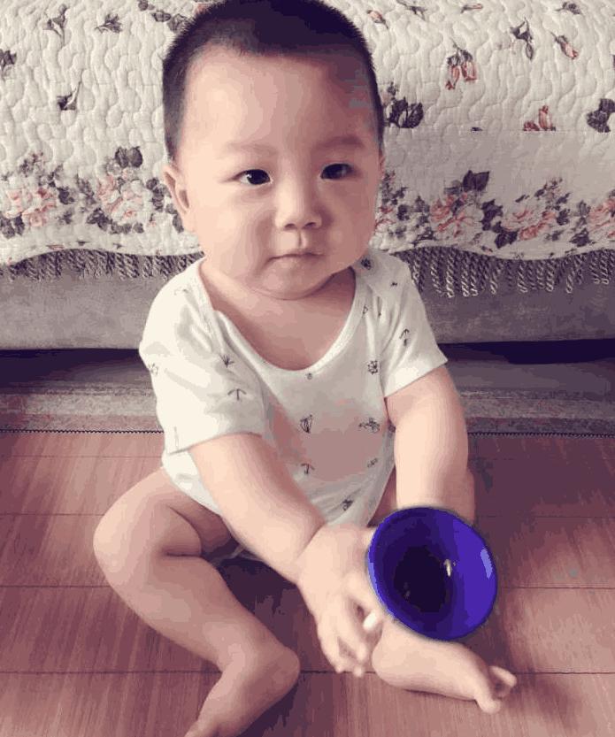 剖腹产打的麻药有什么副作用,剖腹产有哪些副作用和后遗症