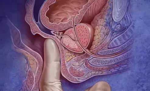 美国看痔疮手术,在美国看癌症和在中国看病的区别