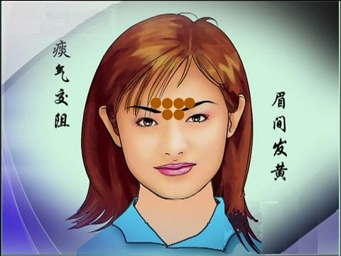 中基中诊试题及答案,中基四本书