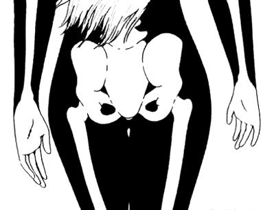 走路扭臀是什么原因,走路扭臀什么原因