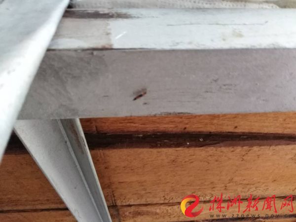 小女孩被虫子咬了差点毁容,医院妇女被虫咬毁容