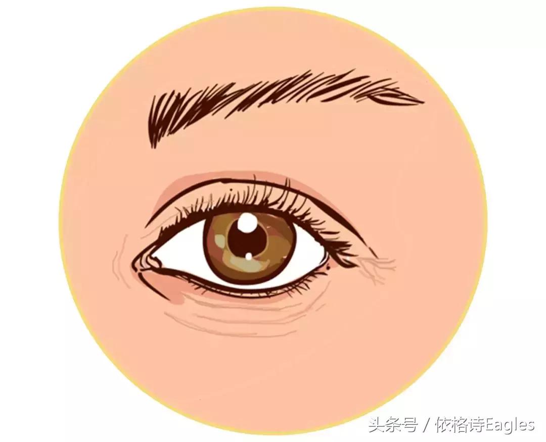 怎么去除黑眼圈和细纹,黑眼圈细纹还有得救吗