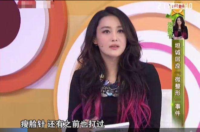 张馨予整容几次,张馨予整容失败了吗