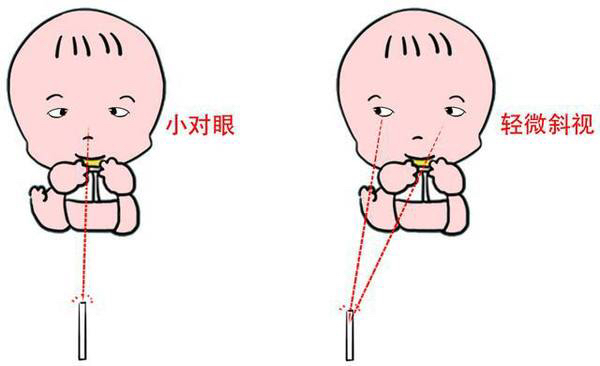 怎么看宝宝眼睛有没有斜视,爸爸妈妈眼中的宝宝是怎样的