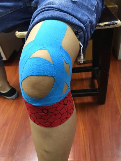 腰腿颈肩痛一贴见效,腰腿肩颈疼贴什么膏药