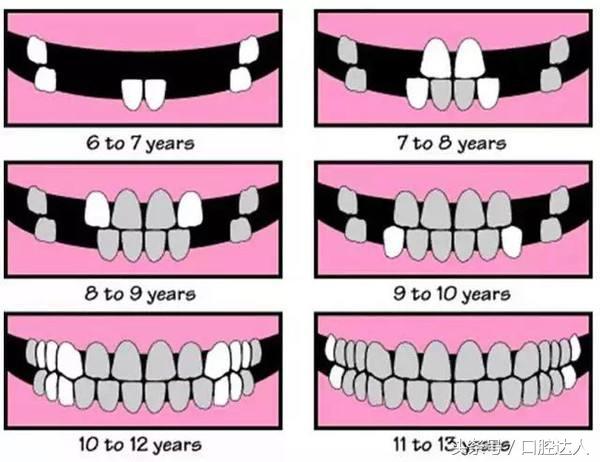 长两排牙怎么办,小孩长两排牙怎么办