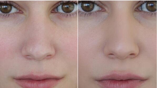 干皮适合用什么粉底液比较好,干皮适合用哪种粉底液比较好