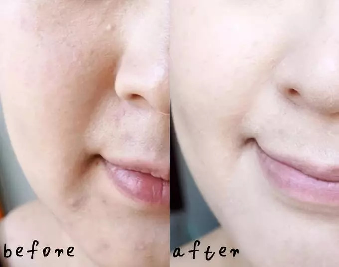 苏菲玛索不老,苏菲·玛索美颜