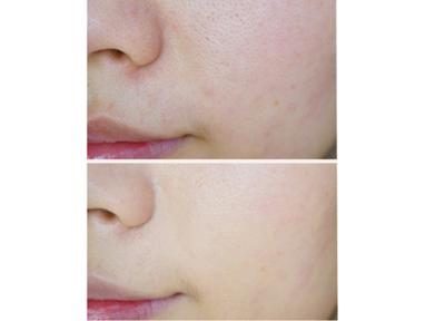 干皮适合用什么粉底液比较好,干皮适合用哪种粉底液比较好