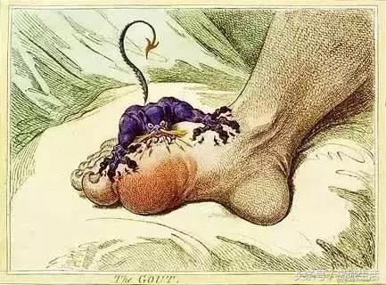 痛风久治不愈怎么办,痛风治疗这四件事真的很重要