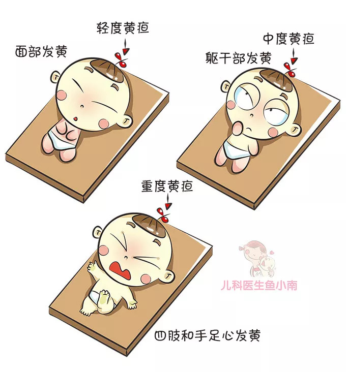 关于新生儿黄疸的7个常识,避免新生儿黄疸的四种方法