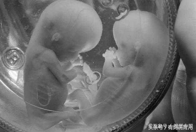 孕期孕妈身体有这3种表现,很可能是动了“胎气”,要及时就医