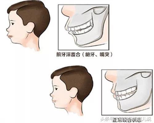 小孩吃饭含在嘴里不肯咽下怎么办,三岁宝宝吃饭老是含在嘴里怎么办