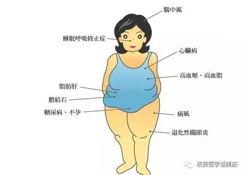 穴位埋线减肥中医临床实践指南,穴位埋线减肥一年一次的效果