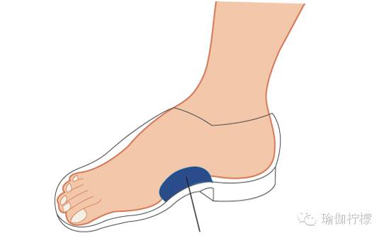 足弓容易出现的问题,足弓出问题的前兆