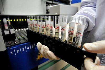 “二孩”放开温州出生缺陷疾病上升！孕期这些检查很有必要