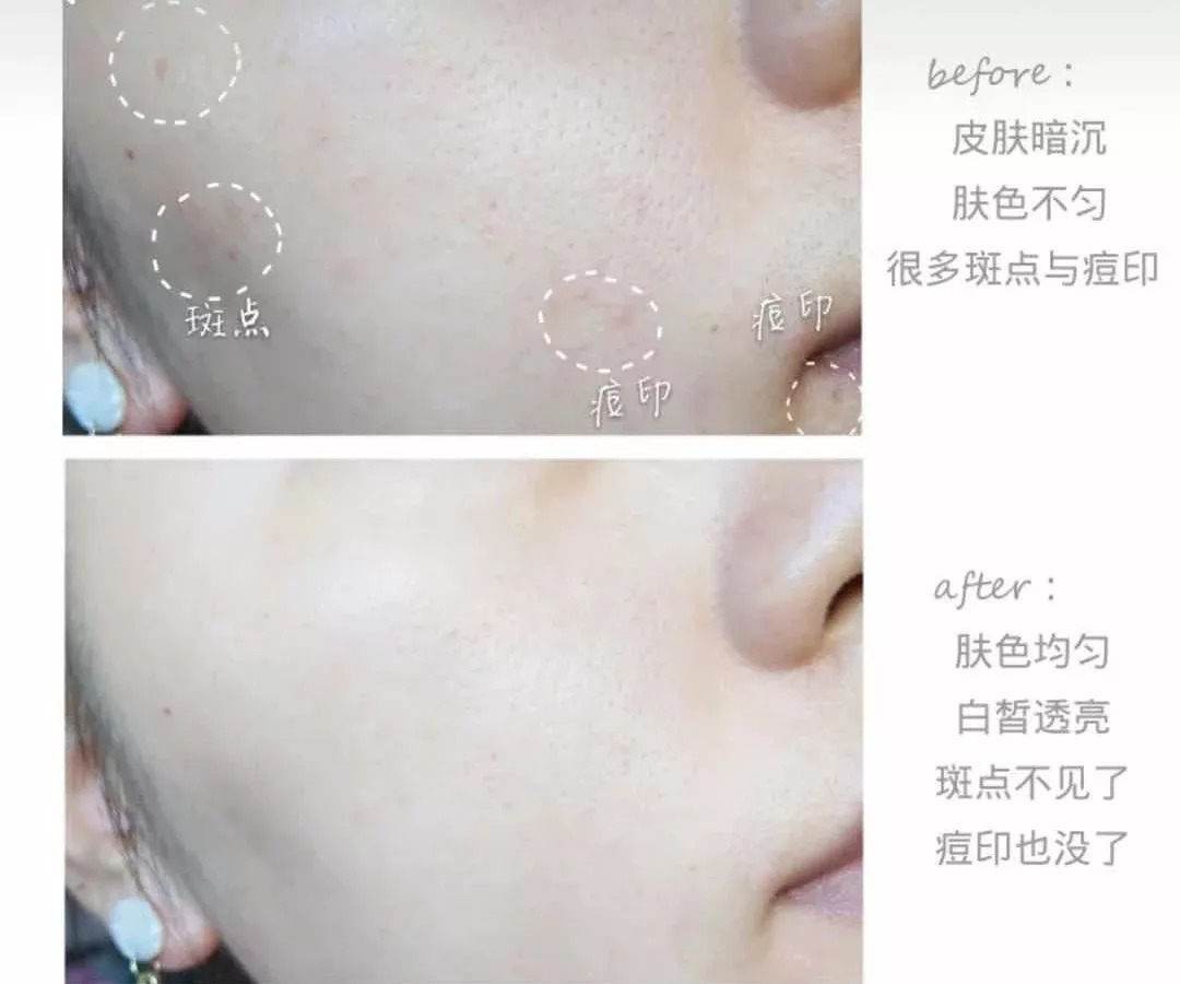 周迅20年前就一脸斑?日本30天击碎顽固斑的好物,快让她用用!