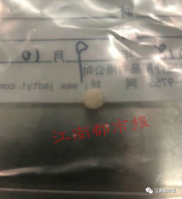 女子脑内取出活虫这是什么虫,男子颅内长活虫