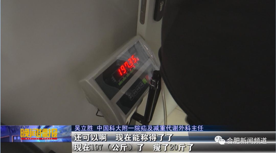 668斤山东第一胖减重手术,安徽第一胖减重