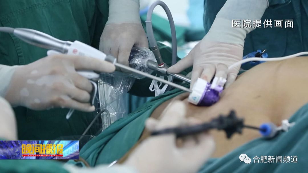 668斤山东第一胖减重手术,安徽第一胖减重