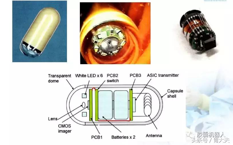 磁控胶囊胃镜技术,中国磁控胶囊胃镜临床应用指南