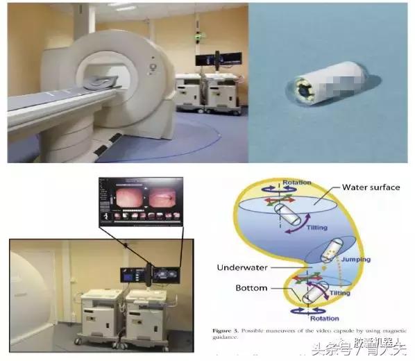 磁控胶囊胃镜技术,中国磁控胶囊胃镜临床应用指南