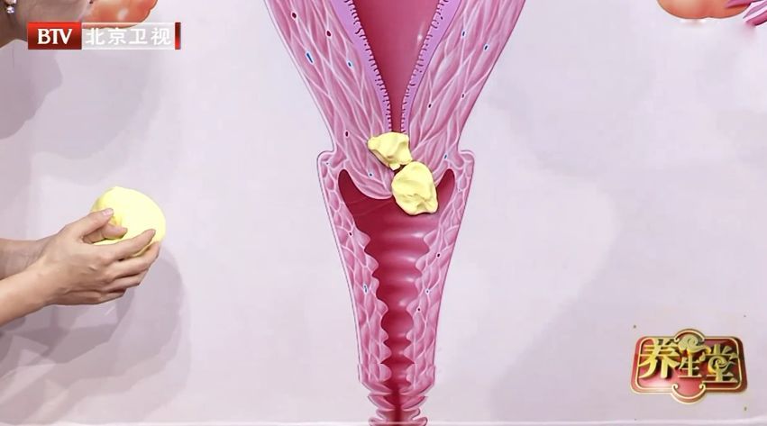 腹部痛阴道出血的症状有哪些,阴道出血小腹胀是什么症状