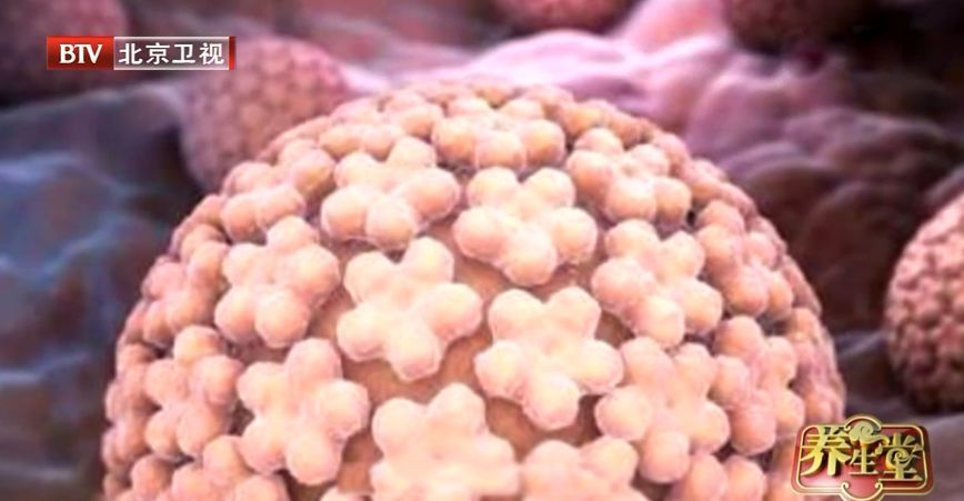 腹部痛阴道出血的症状有哪些,阴道出血小腹胀是什么症状