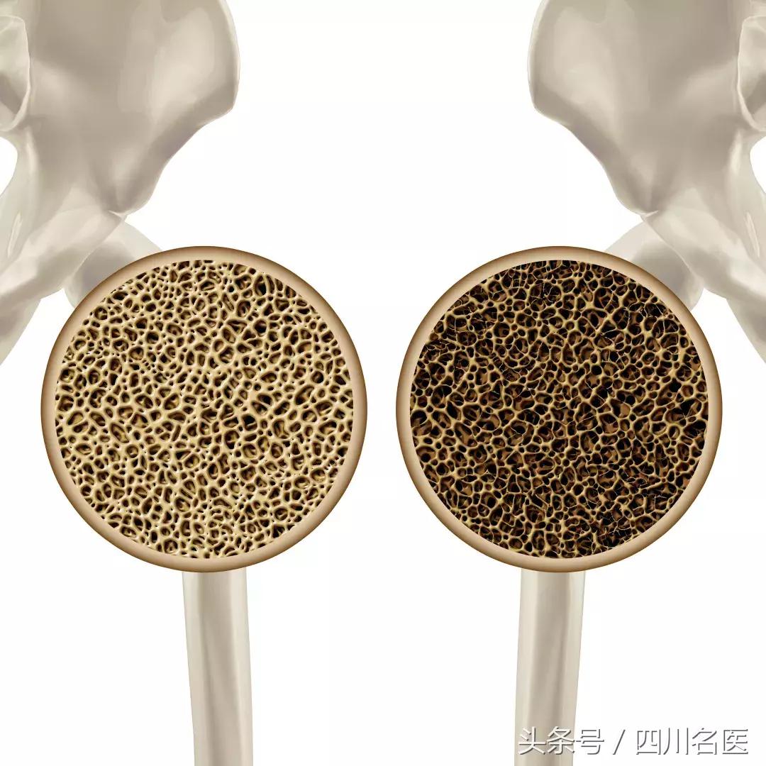 华西医院糖尿病哪个专家比较好,华西医院糖尿病专科攻略