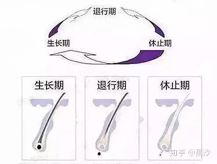 脱发发际线后移你的头发都还好吗,头发快秃顶了怎么解决