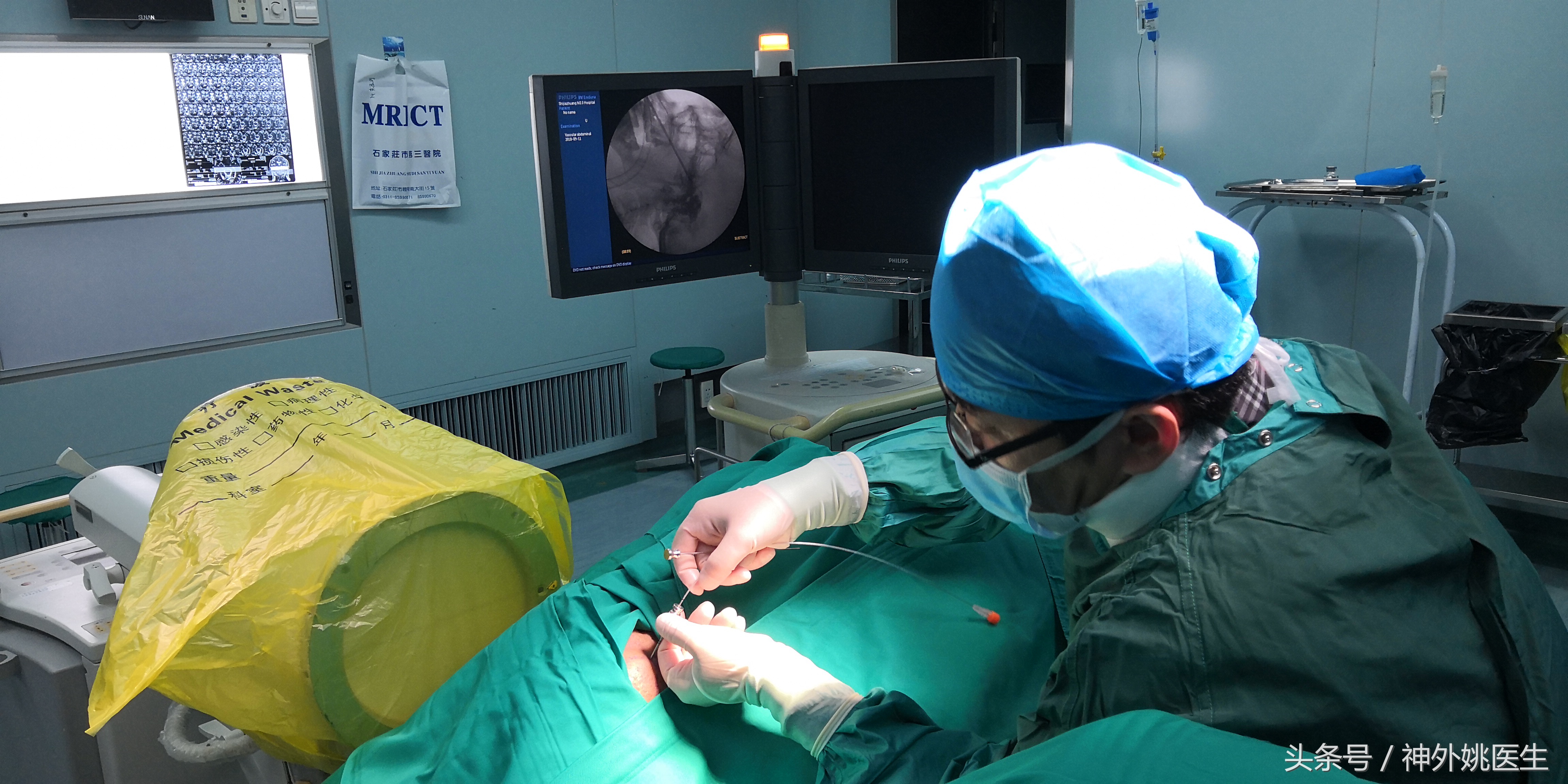 经皮穿刺半月神经节微球囊压迫术,经皮穿刺微球囊压迫术是几级手术