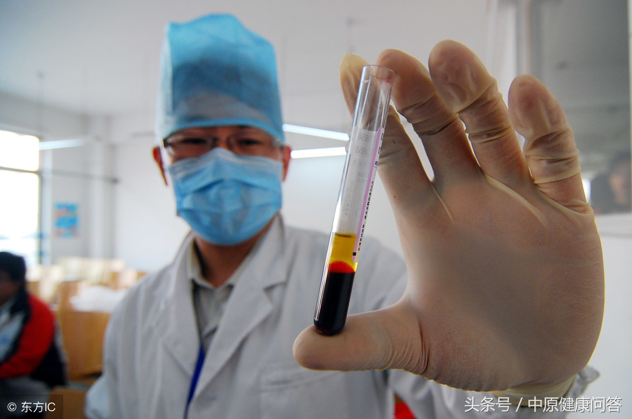 皮肤过敏化验过敏源多少钱,皮肤过敏抽血能查出过敏原吗