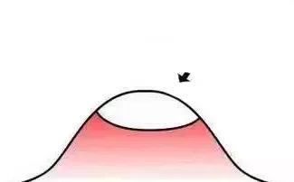 痘痘贴是怎么祛痘的,痘痘贴消炎最快方法