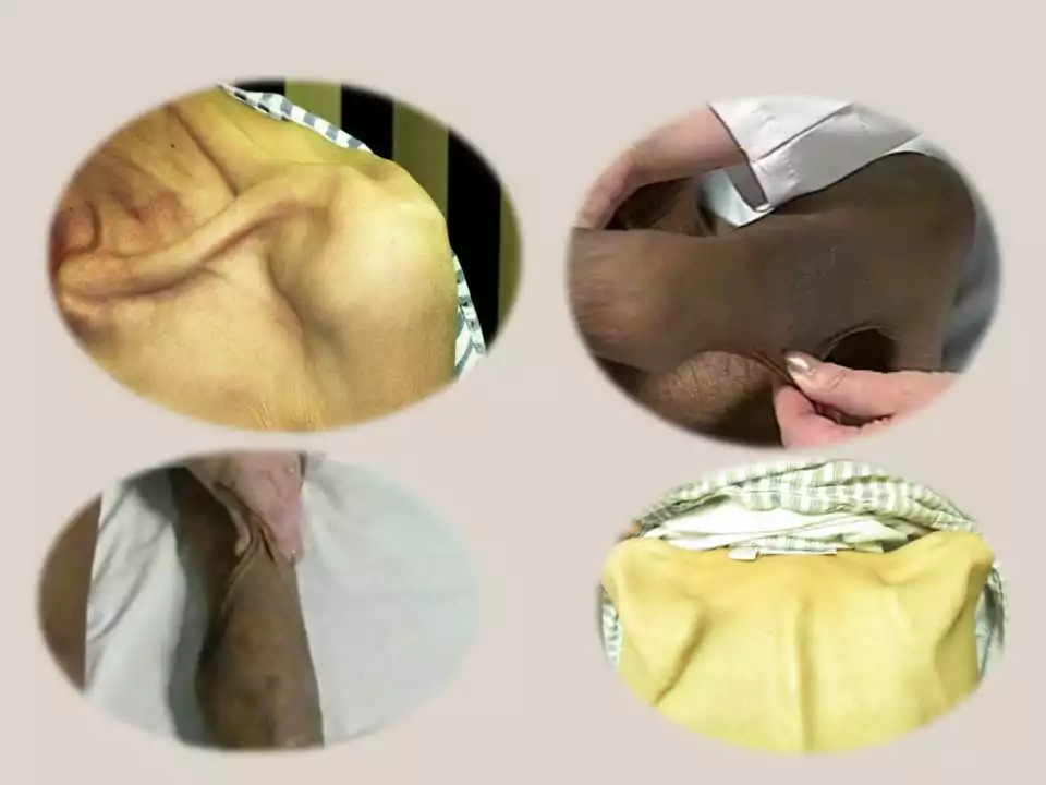 「课件」冯长艳（重庆肿瘤医院）：肿瘤患者的营养与康复指导