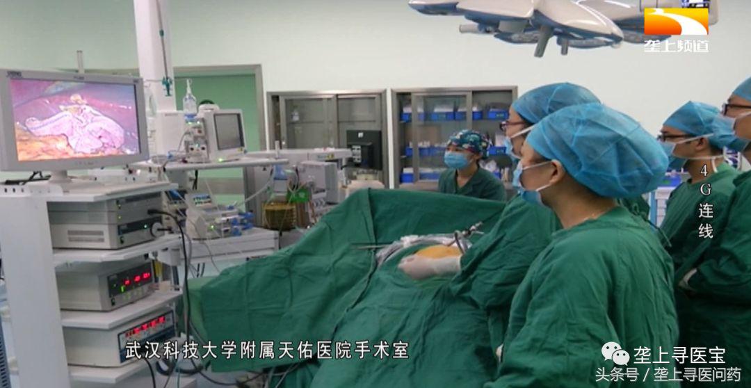 视觉盛宴！速来围观！现场直播腹腔镜胆囊切除术全过程！