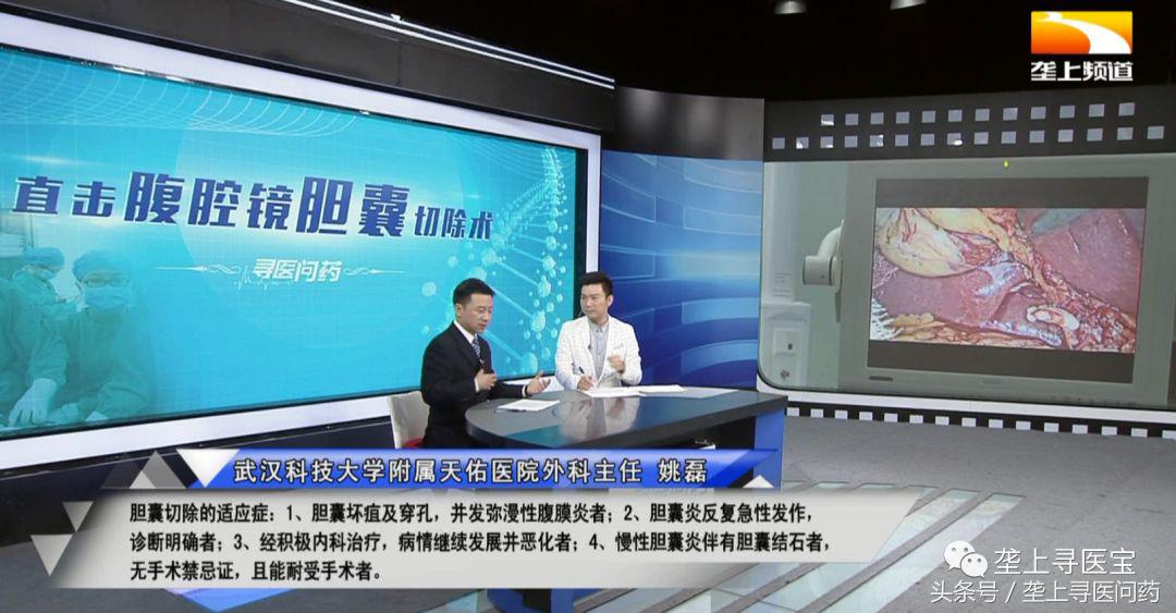 视觉盛宴！速来围观！现场直播腹腔镜胆囊切除术全过程！