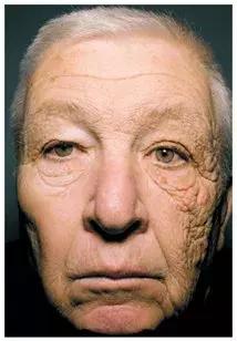 防晒霜加剧衰老,什么防晒霜好用又黑又显老