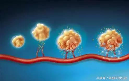 hiv发热和流感发热,怎么判断流感还是hiv