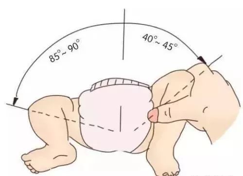 宝宝腿纹有几条,宝宝腿纹多大可以消除