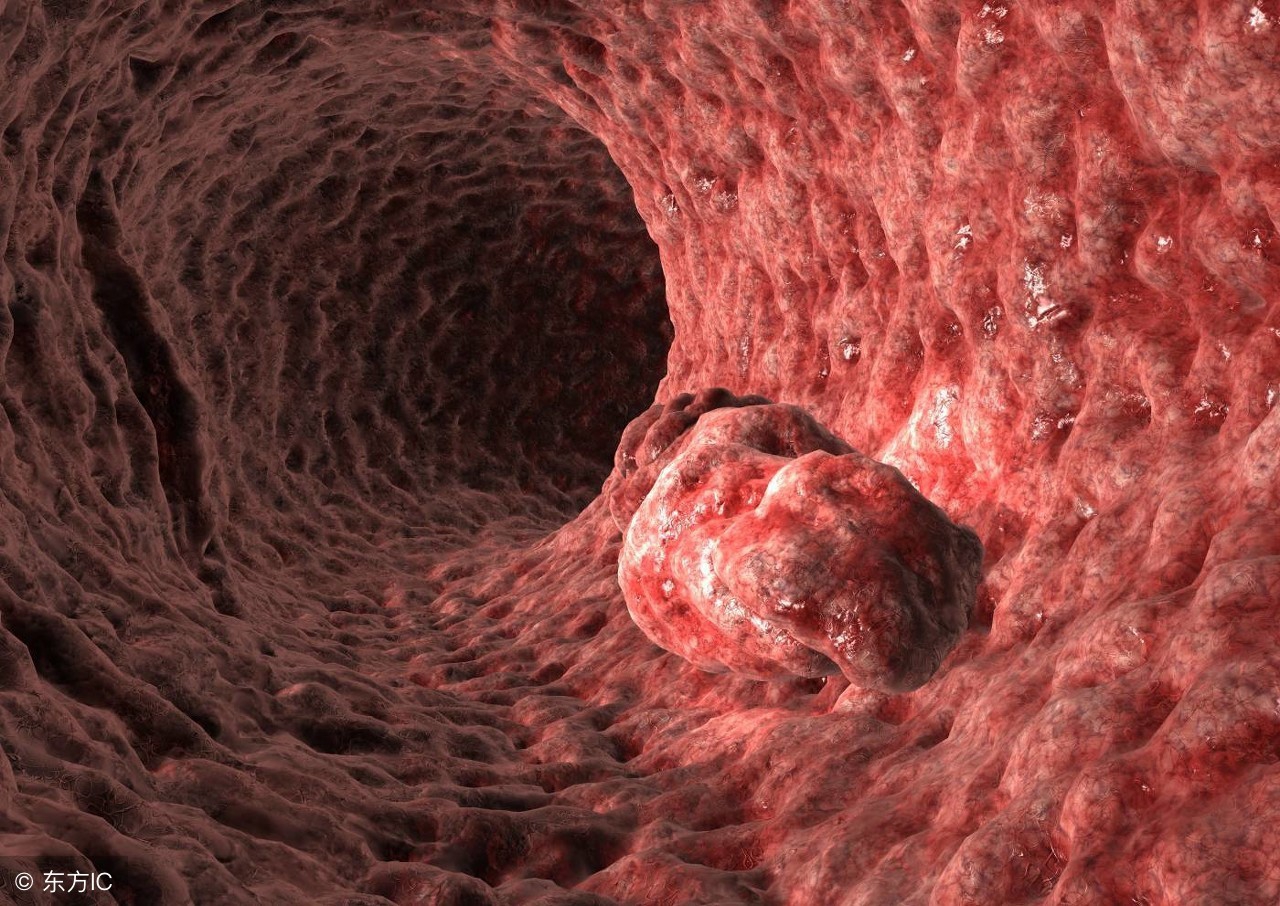 抗肿瘤上市的新药,抗肿瘤上市新药