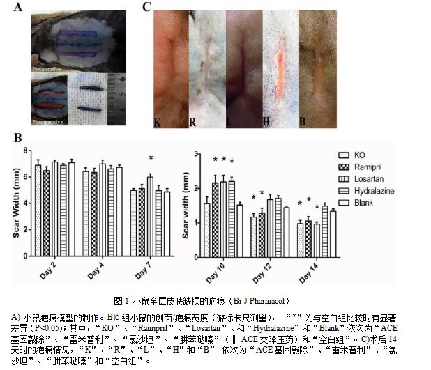 What？高血压降压药还能用来治疤痕？义乌这位整形专家耗费5年时间，取得科研新突破！
