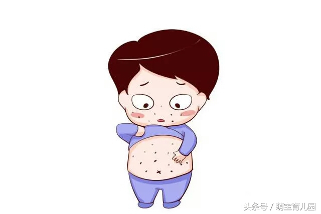 宝宝湿疹要注意哪些事项,宝宝湿疹的注意事项