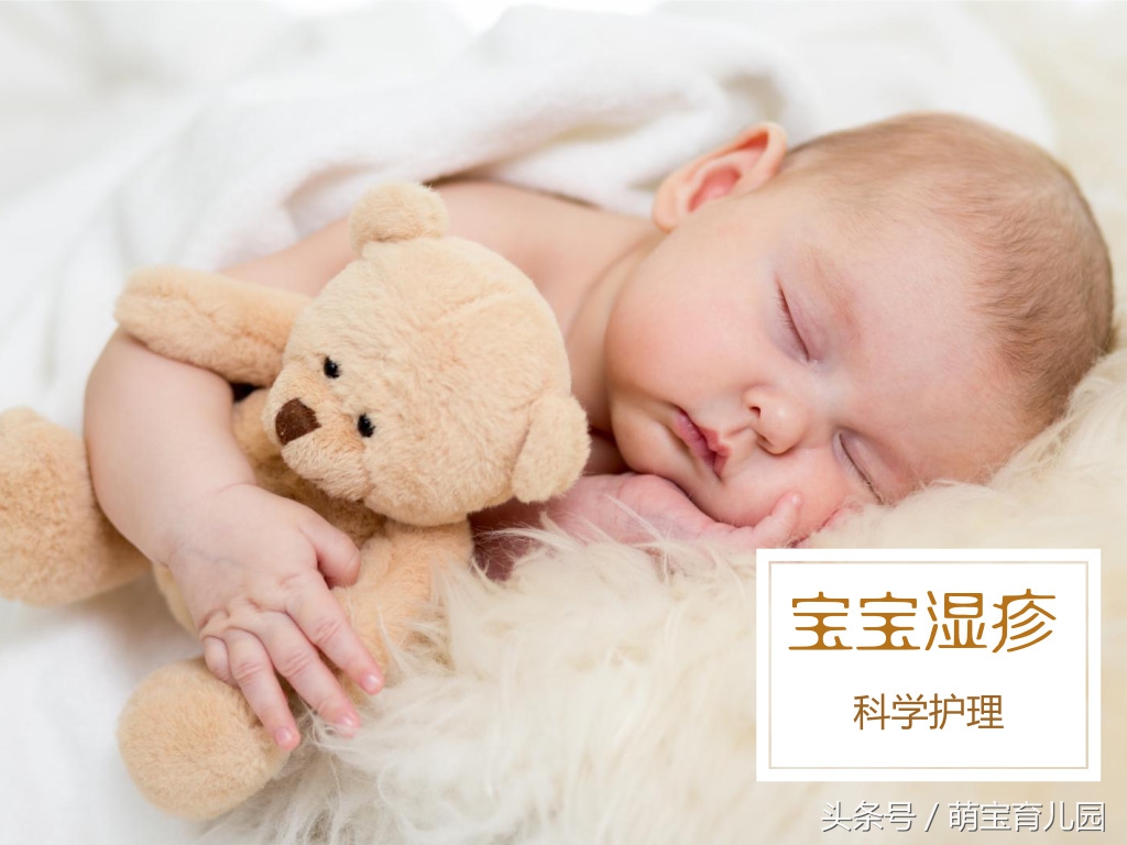 宝宝湿疹要注意哪些事项,宝宝湿疹的注意事项