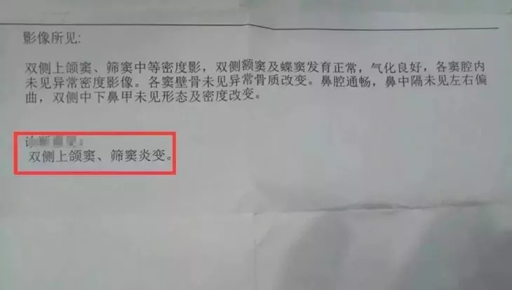 儿童好用的鼻炎喷剂,日本儿童鼻炎喷雾药