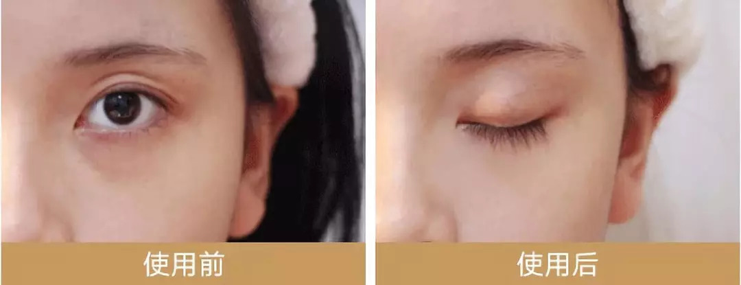 外用中药眼膜,中药眼膜去眼袋眼纹