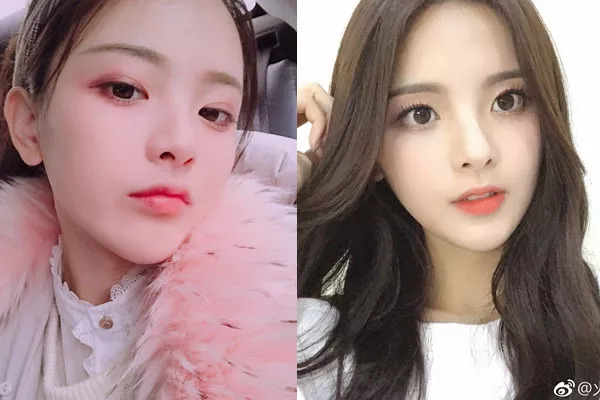 超越啊，你是真不懂美容诶