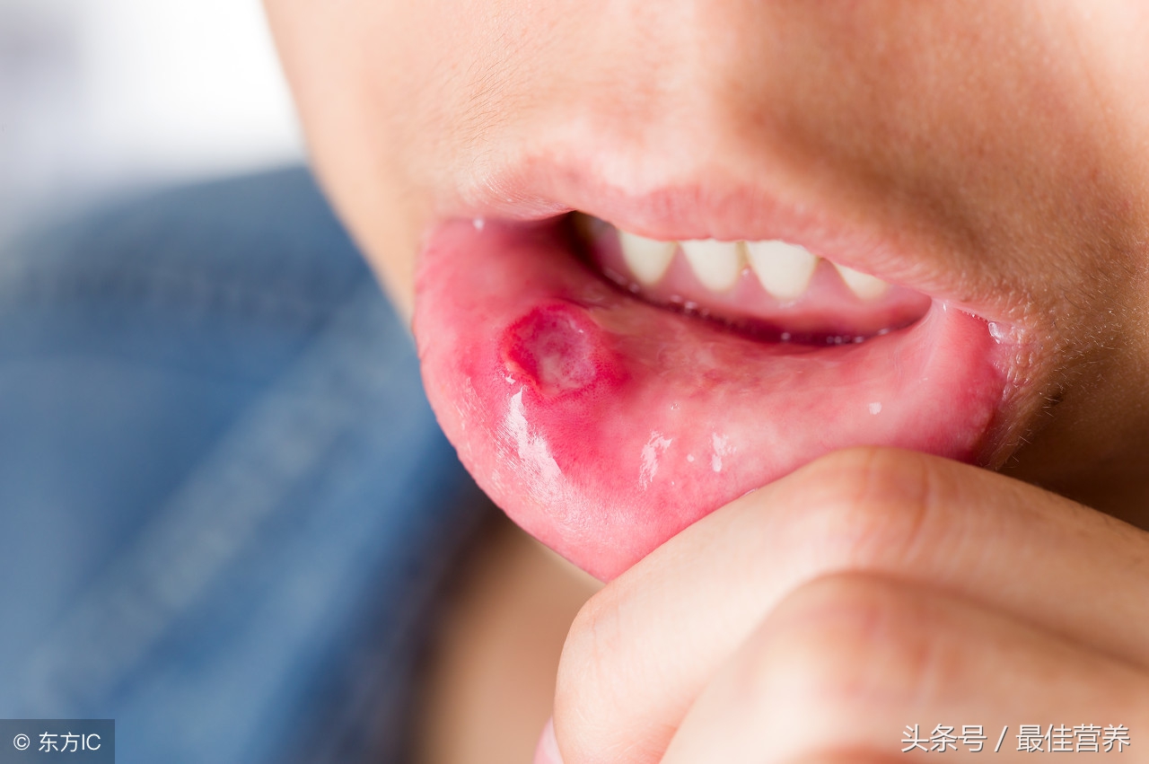 头痛口干舌燥没有食欲怎么回事,疲劳乏力口臭记忆力下降