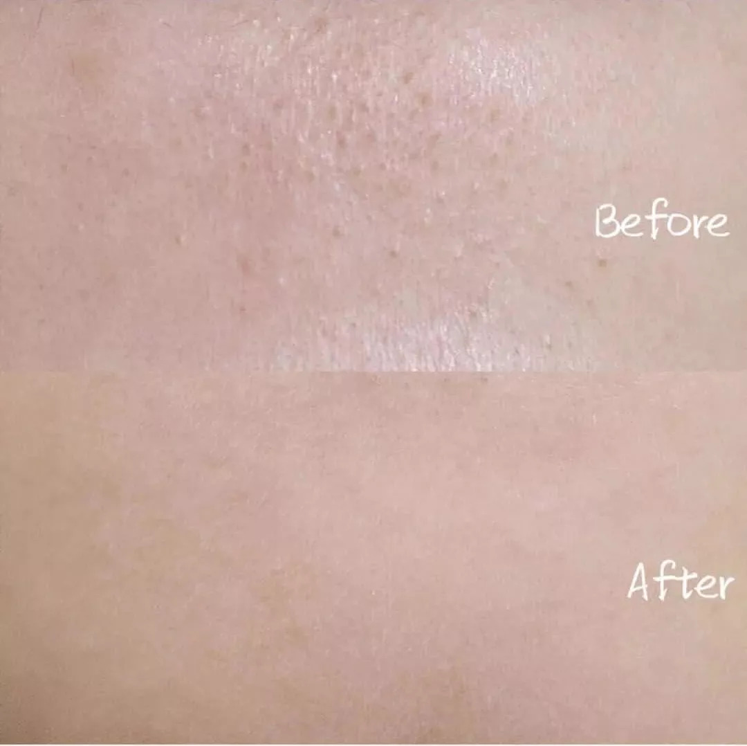 睡一觉毛孔都隐形?顺便还白了2个度,这款整形面膜我服了……